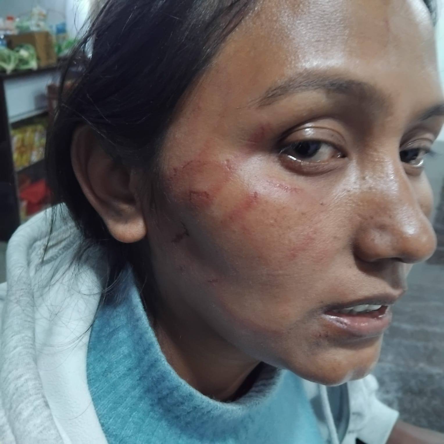 सिन्धुलीमा खाजा घर सञ्चालक महिलामाथि कुटपिट, ट्रक चालक समूह फरार