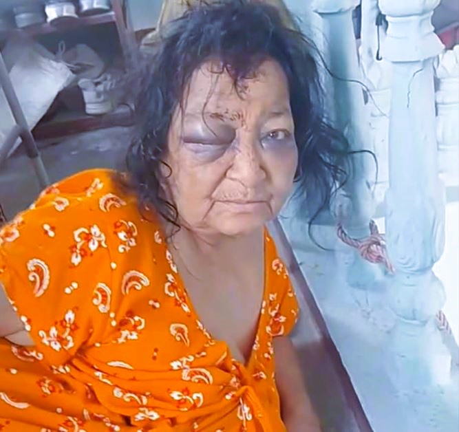 झापामा अपाङ्ग वृद्ध आमामाथि छोराबाट कुटपिट, दुई वर्षदेखि दोहोरिँदै आएको आरोप